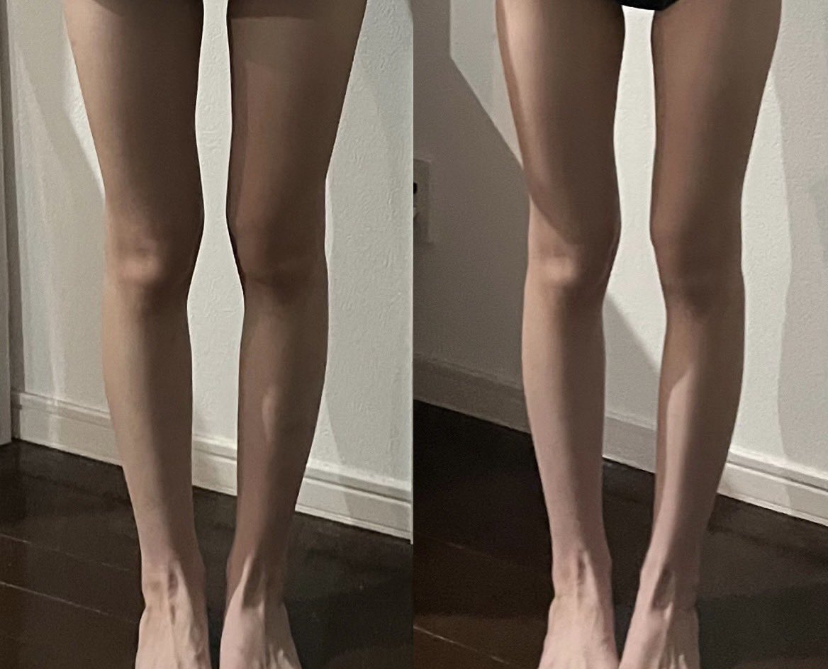 公式】プランエスクリニック（PLAN;SCLINIC） (@plansjp) / Posts / X