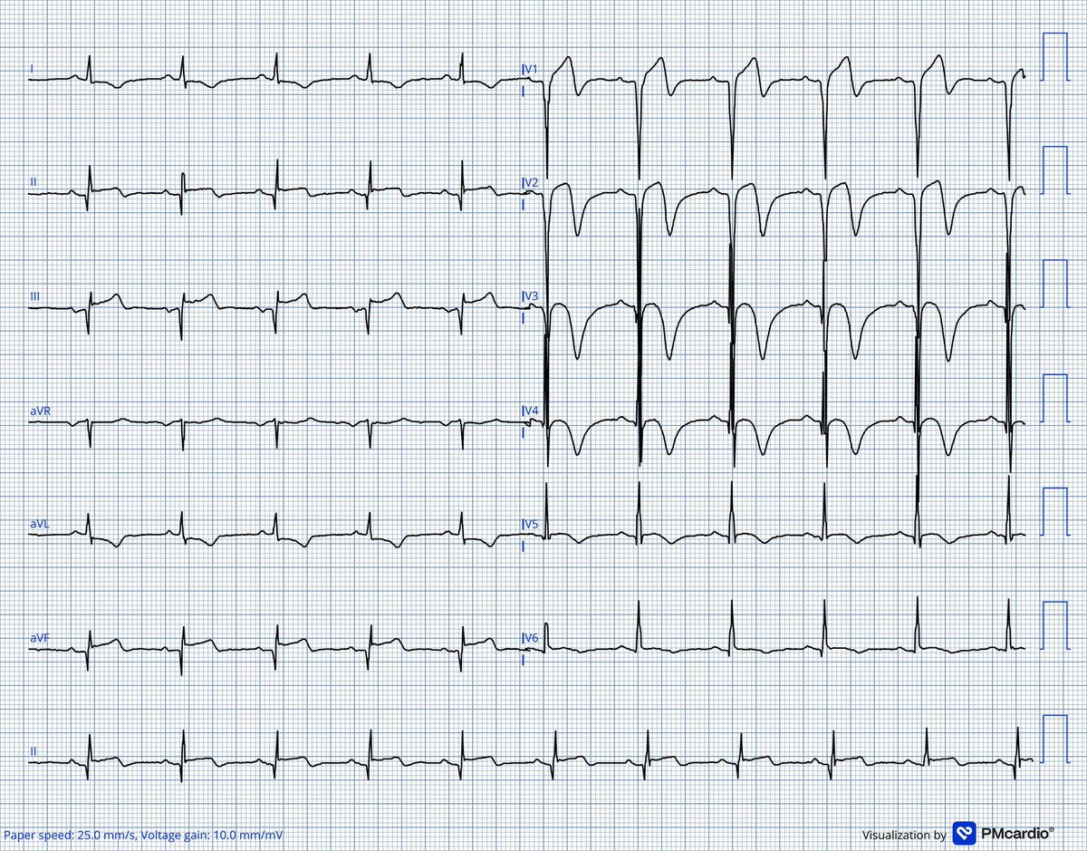 Dr J NELSON OKEMA, MD 🇬🇧 tweet media
