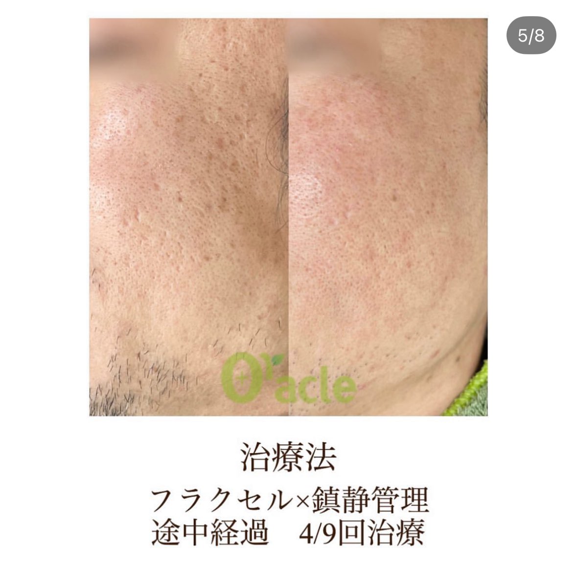 オラクル美容皮膚科 新宿院【公式】 (@oracleclinic) / Posts / X