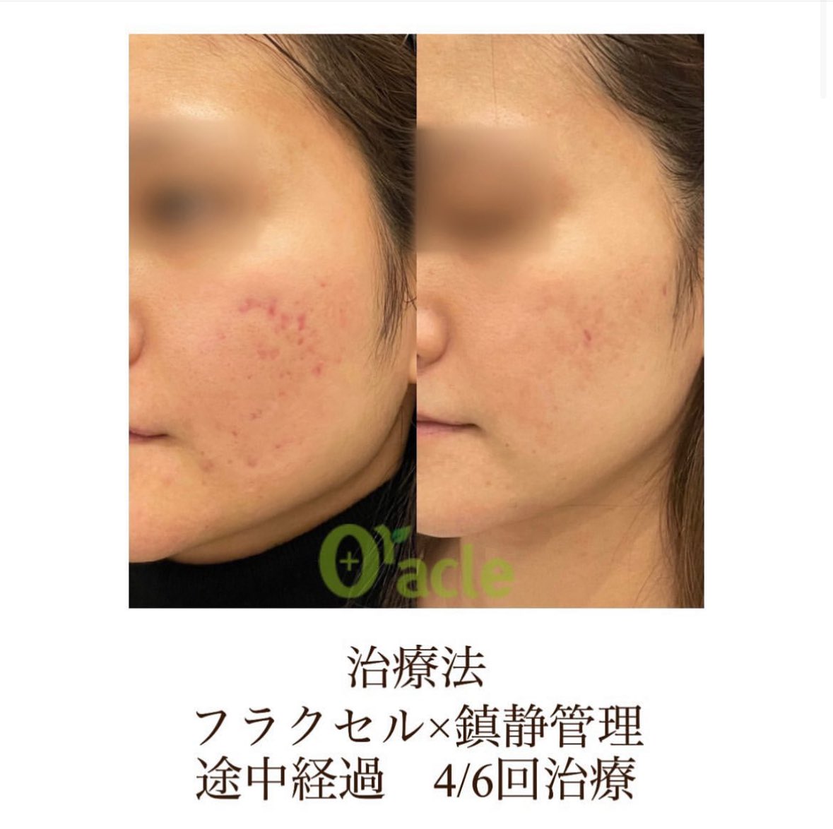 オラクル美容皮膚科 新宿院【公式】 (@oracleclinic) / Posts / X