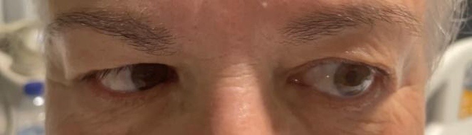 Revista de Neurología tweet media