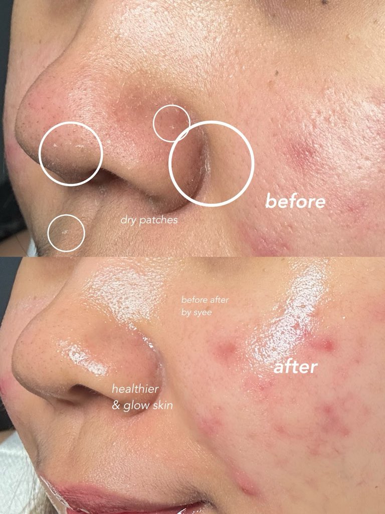 syee 🧃 tweet media