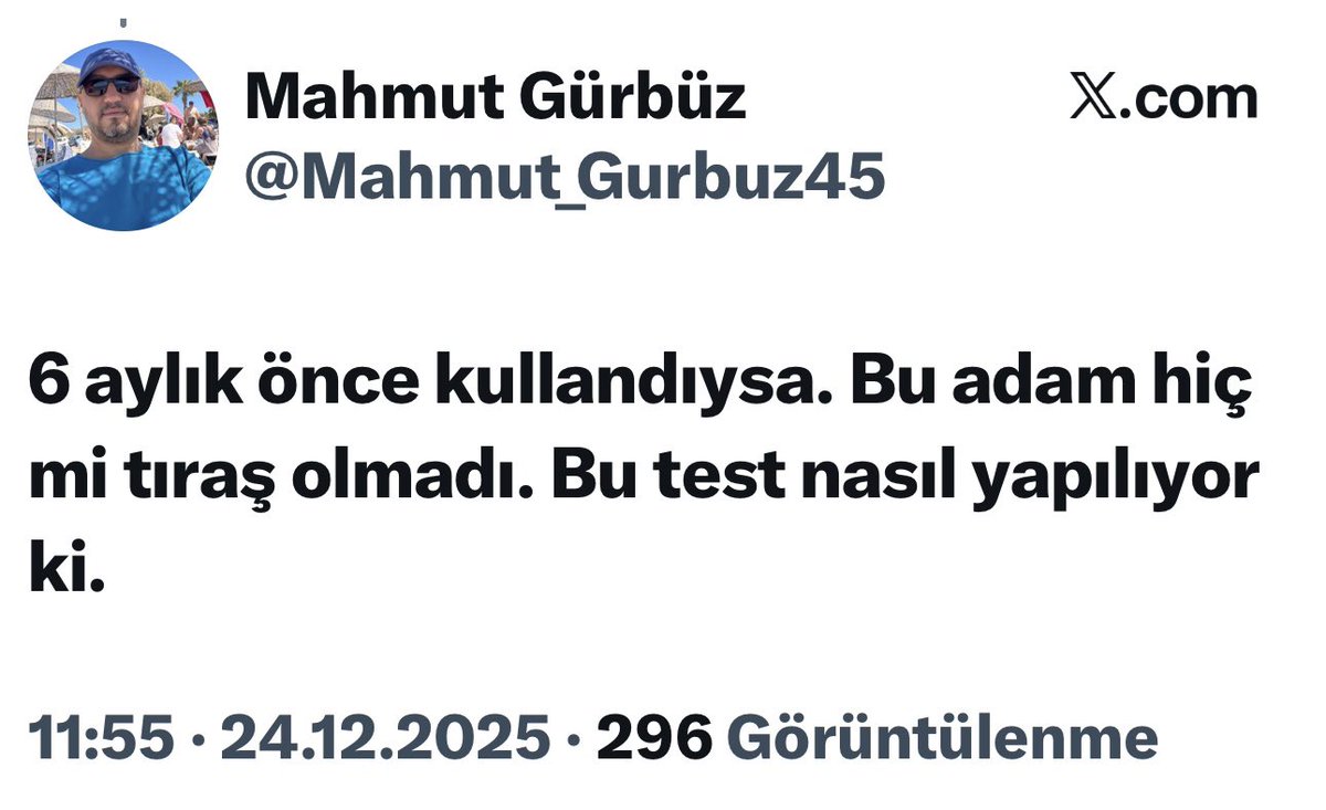 İşte laf anlatmaya çalıştığımız tayfa :)))
Biri diyor “başkasının saçından bulaşmış olamaz mı?i, diğeri 
“6 aydır saç traşı olmadı mı?”
İşte bu kafayla bilgi sahibi olmadan fikir sahibi de olunuyor demek ki…