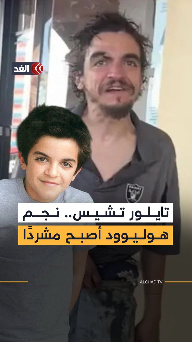 تايلور تشيس.. نجم هوليوود الذي فقد الشهرة وأصبح مشردًا بين شوارع #كاليفورنيا 