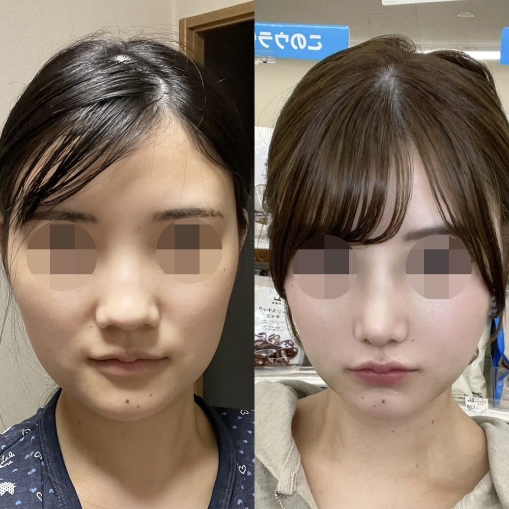モ tweet media