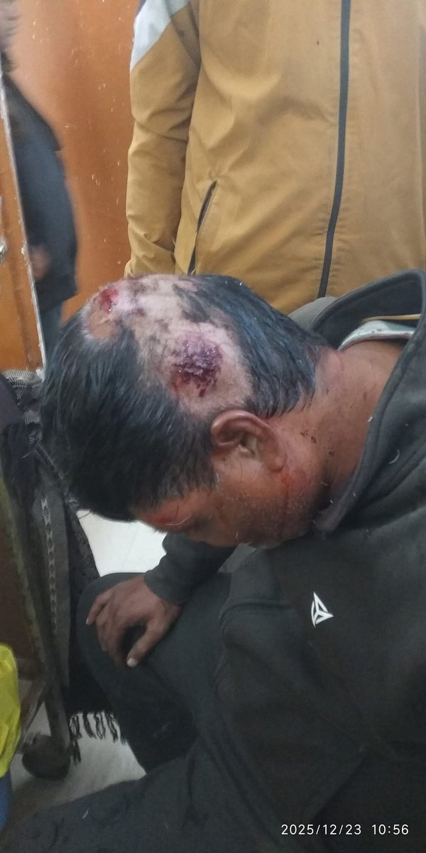 उत्तर प्रदेश में नयी तानाशाही आयी हैं,
पहले अपराधी आपको गोली से मारे उसके बाद पुलिस आपके ऊपर ही गम्भीर धाराओं में मुकदमा भी दर्ज करेगी।
