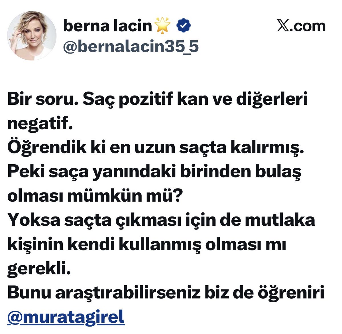 Şimdi Berna ile benim oyum bir mi 😅 👇🏼🤦🏻‍♀️