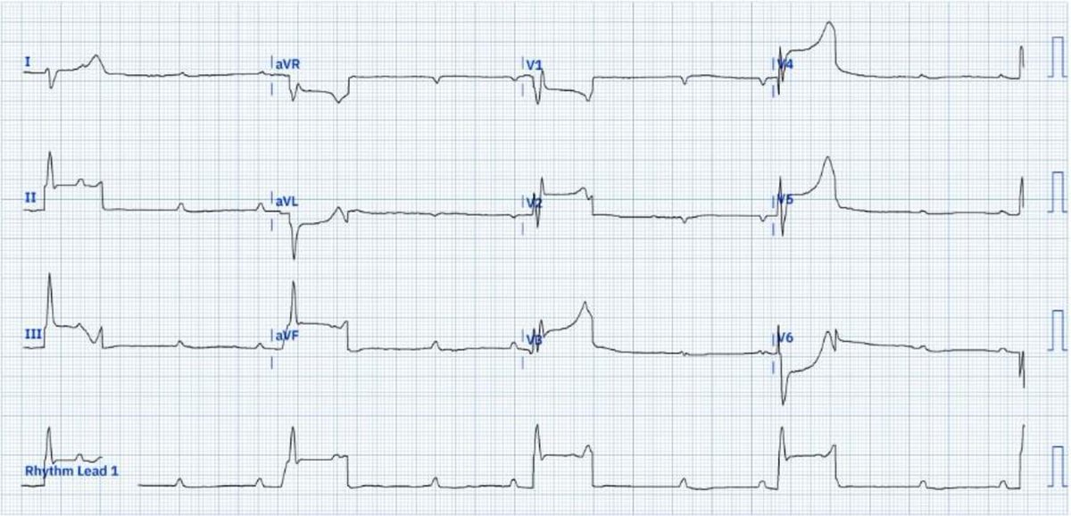 Heart_BMJ tweet media