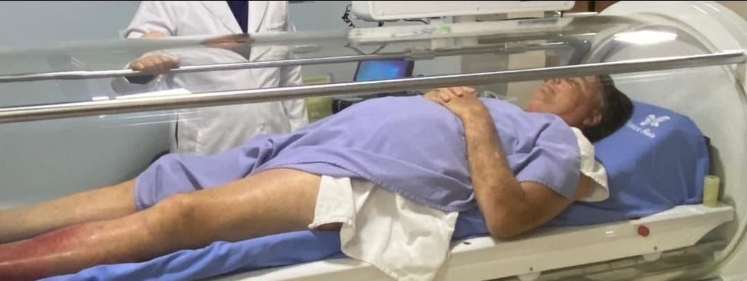 NP__Oficial's tweet image. 🚨 Agora l Corpo de Bolsonaro deixa PF e é levado para hospital em Brasília