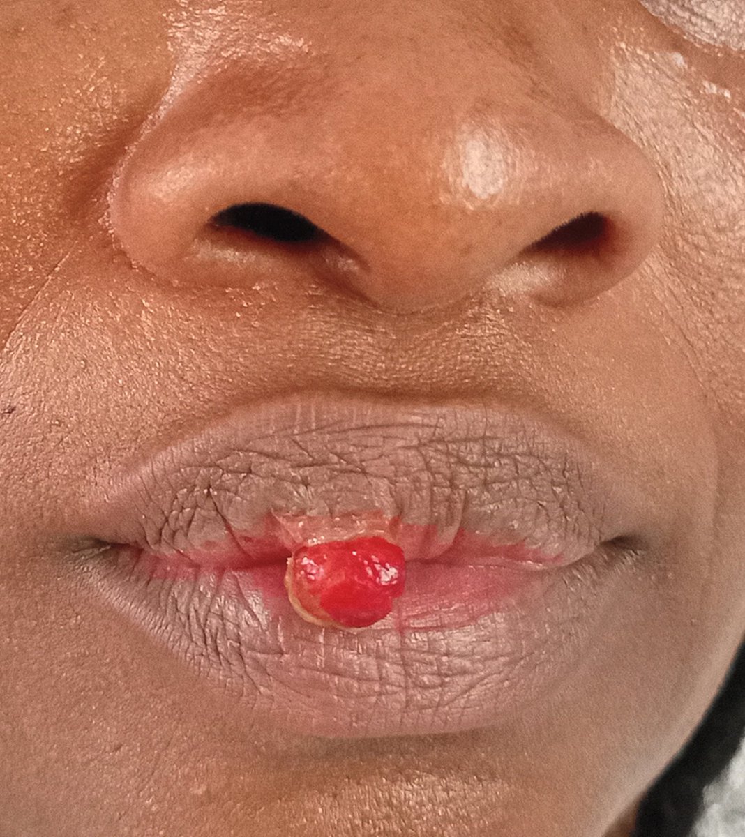 CardiovascularCorner tweet media