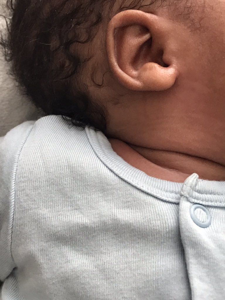 RoseTyindyi's tweet photo. I’m a mommy 💙🤍 https://t.co/65FjiYk9mq