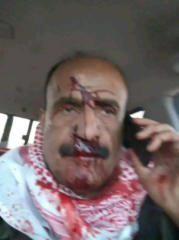 تعرض للضرب ونجى من الموت على يد مليشيا الانتقالي الاماراتي. 
#العميد محمد عبدالله الصبري،  مدير أمن شركة النفط حضرموت
