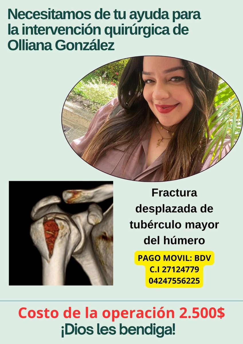 Una de mis estudiantes tuvo un accidente y necesita cirugía cuanto antes. Ayudemos a Olliana, por favor ❤️‍🩹