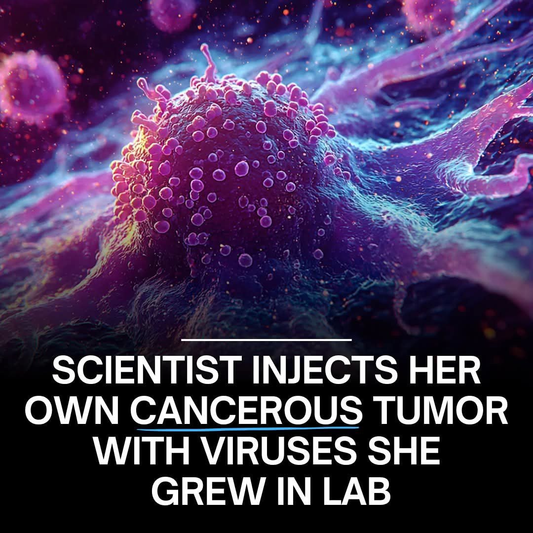 ShiningScience's tweet image. 🦠 A virologist injected her own tumor with lab-grown viruses. Now, she’s cancer-free.

In a bold act of scientific self-experimentation, Croatian virologist Dr. Beata Halassy successfully treated her own recurring breast cancer using lab-grown viruses. 

After facing her third…