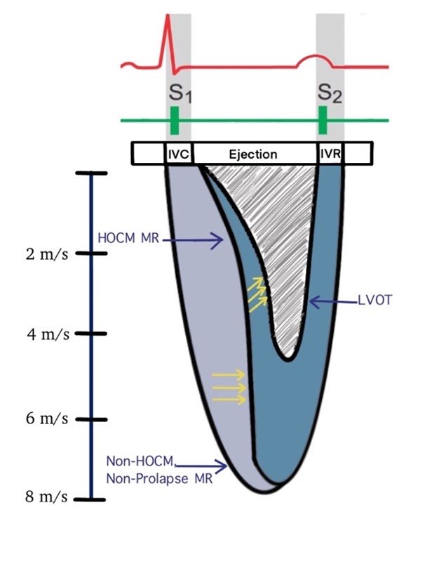 NephroPOCUS tweet media