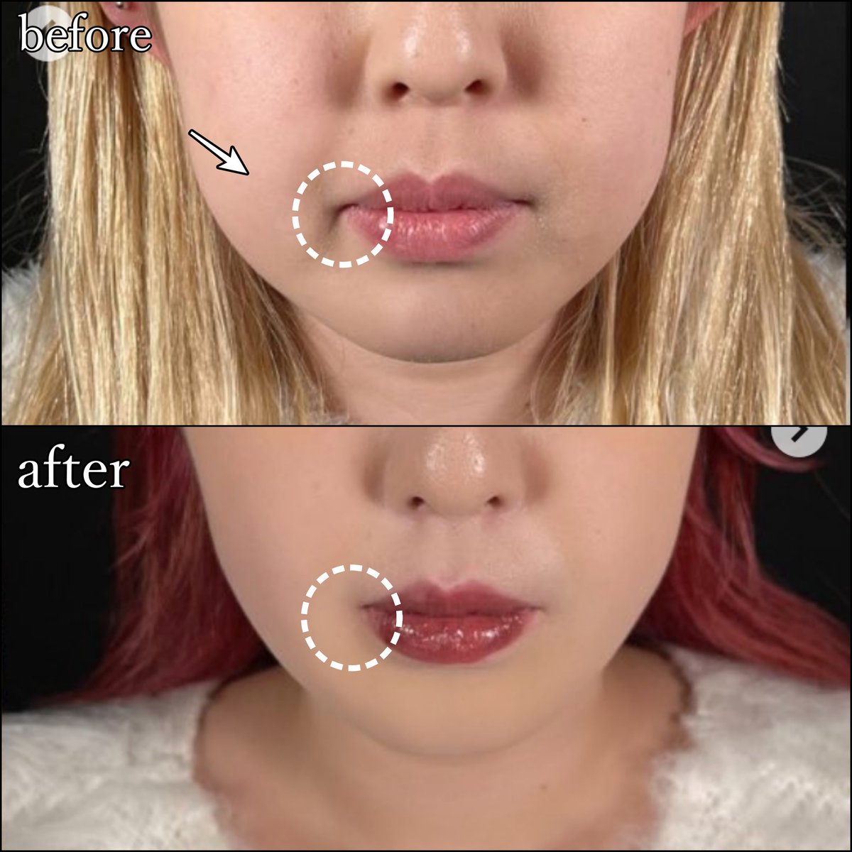 忘れ鼻の美容外科医 Dr小池 tweet media