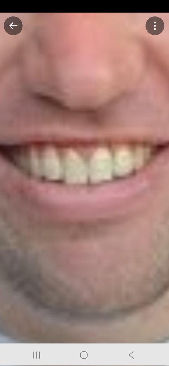 SeanFagan67's tweet photo. @Craig_Dennett Aye nae bother sheep teeth 😬 https://t.co/Mr9YDt5C4r