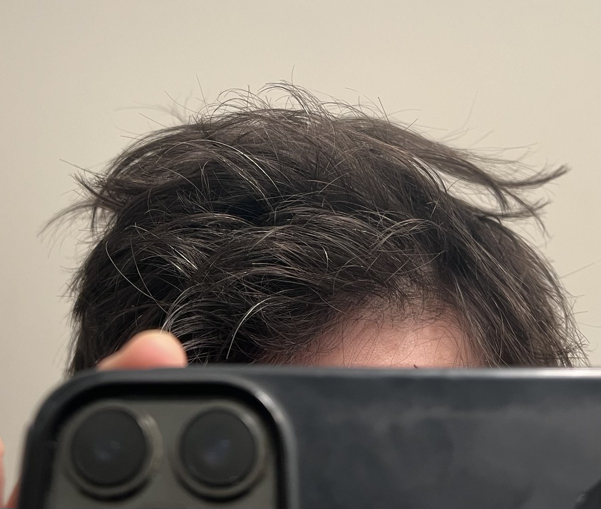Every morning I see more gray hairs.

Gonna die soon.