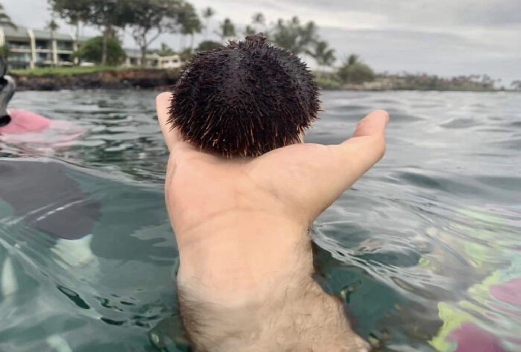 ウニ取ったときの写真が完全に葉加瀬太郎のヌードで草