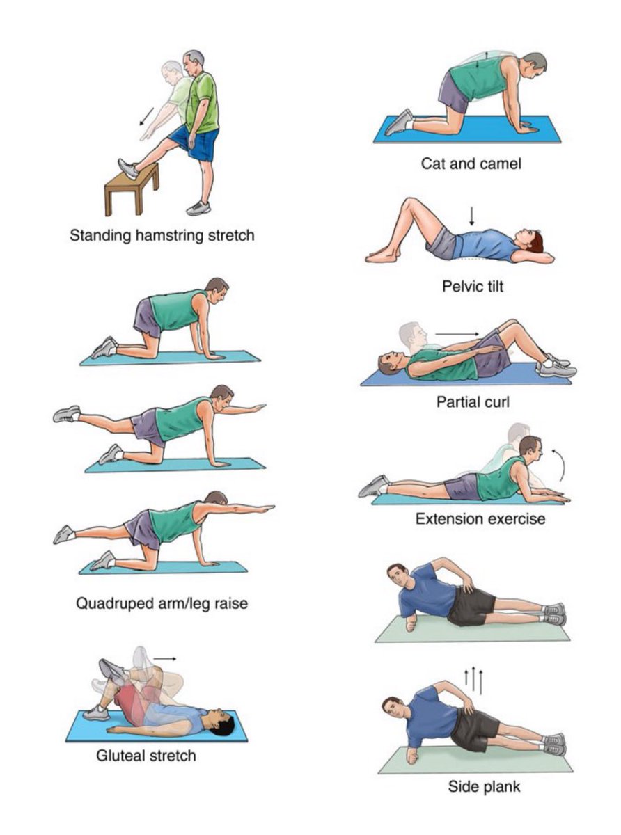 lilJnotcute's tweet image. อันนี้เรียกว่า lower cross body syndrome ได้นะคับ ถ้าเราหลัง+ขาหน้าตึง แต่กล้ามเนื้อท้องไม่แข็งแรงก็จะเป็นแบบในรูปเลย นานๆไปปวดหลังได้(มาก🥹) แนะนำออกกำลังกายพวก core stability กับยืดหลัง+ขาเป็นประจำคับบ