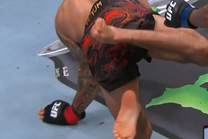 ufcstreamse's tweet image. why the fuck is the ufc medical team (Which spends millions of dollars) is saying it was a shoulder injury for Pantoja but clearly it was a elbow injury. Take their degrees away #UFC323 #UFC324 #UFC