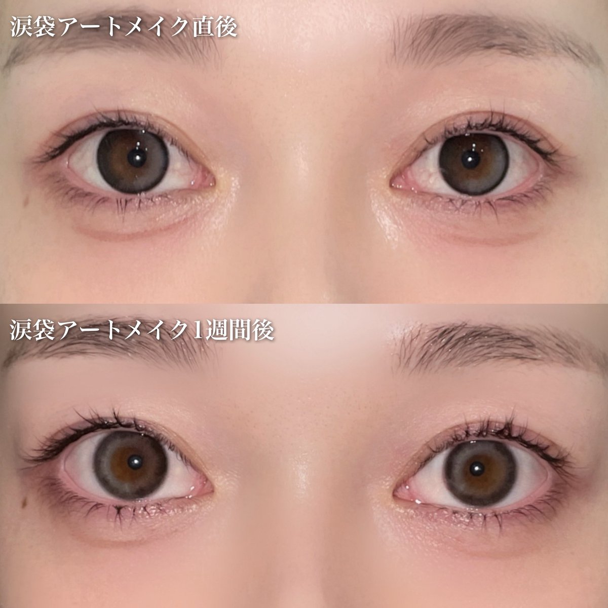 1週間経過レポ❕ アートメイク直後は線って感じだったけど、1週間経つ