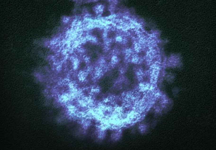 bactiman63's tweet image. #MiddleEast respiratory syndrome #coronavirus (#MERS-CoV) 2025

Since the beginning of 2025, and as of 10 December 2025, 14 MERS cases (including three fatalities) have been reported with date of onset in 2025. Among these, 12 cases (including three fatalities) have been reported