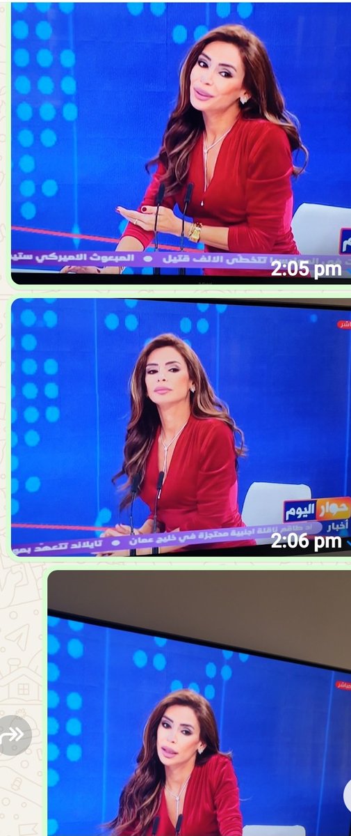 الاعلامية جويل بو يونس بعد التجميل مش مصدقه حالها بتحكي مع الضيف وعينها عحالها ...كتير هالقد مع انك محاورة شاطرة بس كتير مشغولة بوجك بعد التجميل