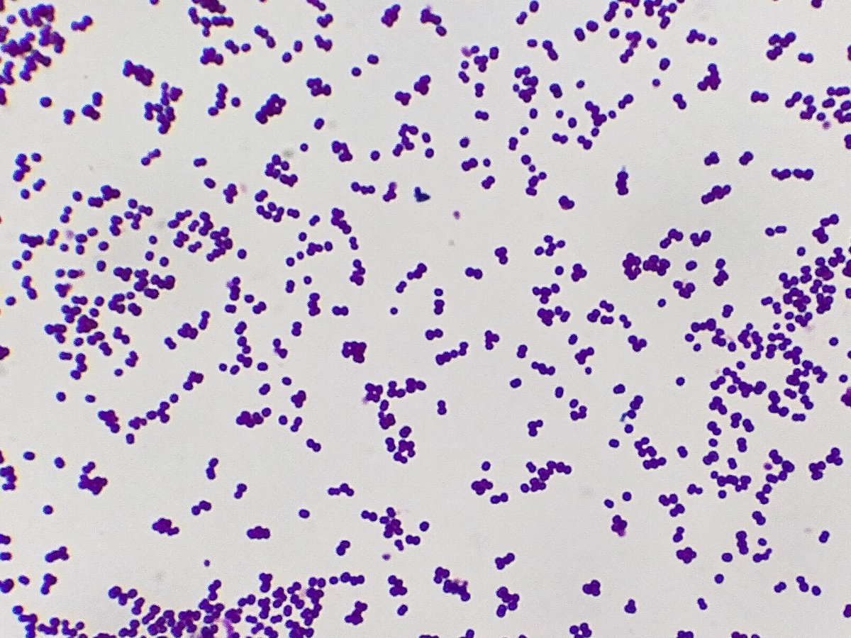 Quality_bio's tweet photo. #معلومة_سريعة
بكتيــــريا (Staphylococcus epidermidis)
❶ ملوّث ومسبب للعدوى!
❷  فلورا طبيعية في العين والجلد، لكنه يشكل خطرًا
❸ السبب الأكثر  لتلوث مكونات الدم ومزارع الدم
❹ مسؤول عن عدوى القسطرة والأنابيب الوريدية 
❺ تعُرف ب Coagulase سلبي وحساس للـ Novobiocin
#مختبرات_طبية https://t.co/re3h12Pmcq
