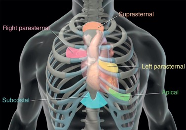 Ahmedata7777's tweet photo. Different Right Parasternal Echo Views

》To assess structures such as:

●Ascending aorta and aortic root

●Superior & inferior vena cavae

●Right atrial anatomy and atrial septum

It can be particularly useful when standard left parasternal views do not provide adequate imaging, such as in evaluation of aortic stenosis or aortic dilatation. 

》Patient Position

Typically lies in right lateral decubitus (turned onto their right side) — this brings the heart closer to the right chest wall. 

https://t.co/FmPHmQxlPg