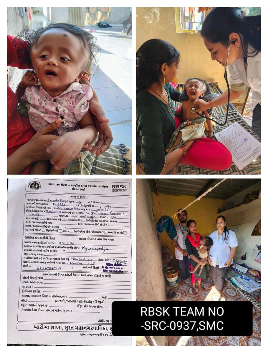 #RastriyaBalSwasthyaKaryakrm  
Home visit of child having Hydrocephalus is given Sandarbh card &amp; counseling to parents by RBSK Team. Surat Municipal Corp <a href="/GujaratSHRBSK/">Gujarat SH (RBSK) Rashtriya Bal Swasthya Karyakram</a> <a href="/GujHealth/">Gujarat Health</a> <a href="/NHMGujarat/">NHM Gujarat</a> <a href="/MoHFW_INDIA/">Ministry of Health</a> <a href="/MoHFW_GUJARAT/">Ministry of Health</a> #GujHFWDept <a href="/MySuratMySMC/">My Surat</a> <a href="/SuratSmartCity/">SuratSmartCity</a>