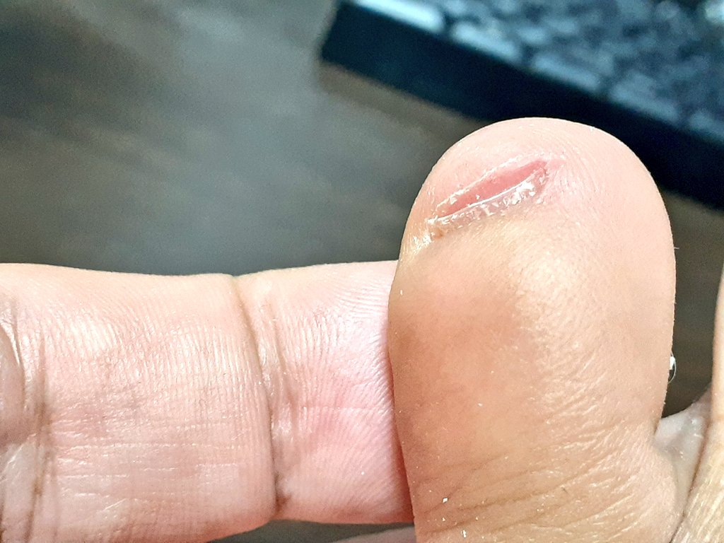 左足の小指の爪 うわーっ！左足の小指の爪切りすぎた！なぁ、俺の小指……どう思う？
