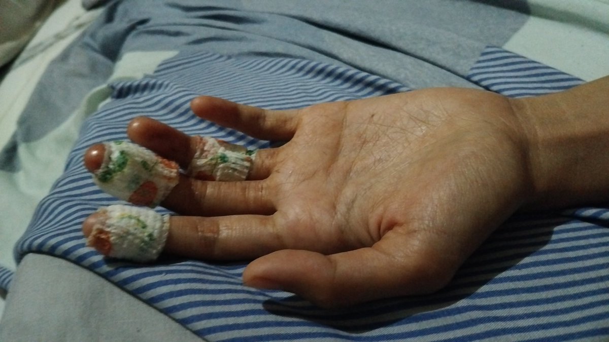 Sakit bangettt yaallah pas pengangguran gini kenapa dikasih cobaan seberat ini nabrak mobil orang,  motor rusak parah harus berobat dan biaya bengkel motor yang lumayan banget bagiku yang nganggur ini, niat irit malah pengeluaran banyak 😭