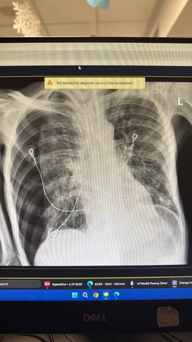 vape led Fact Check: Did Vaping Cause a Man's Collapsed Lung? main image 0