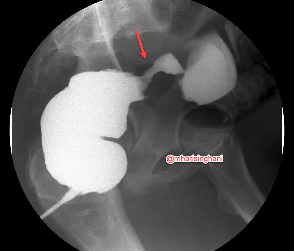 Mukesh Harisinghani tweet media