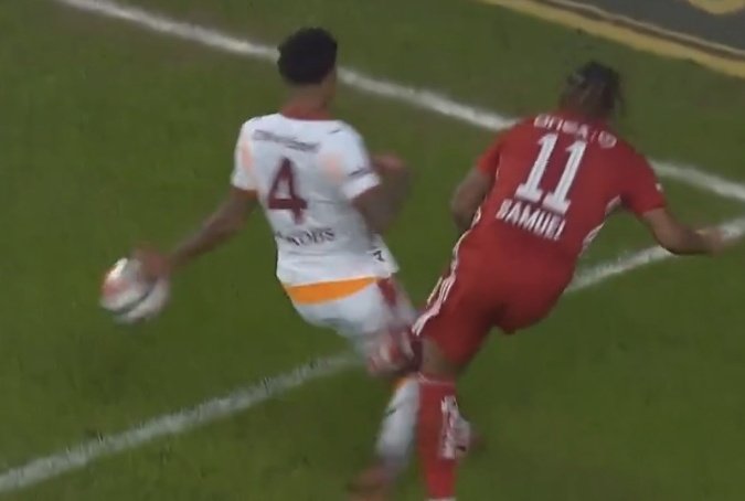 Eline yanlışlıkla çarpmış arkadaşlar olur bazen böyle.