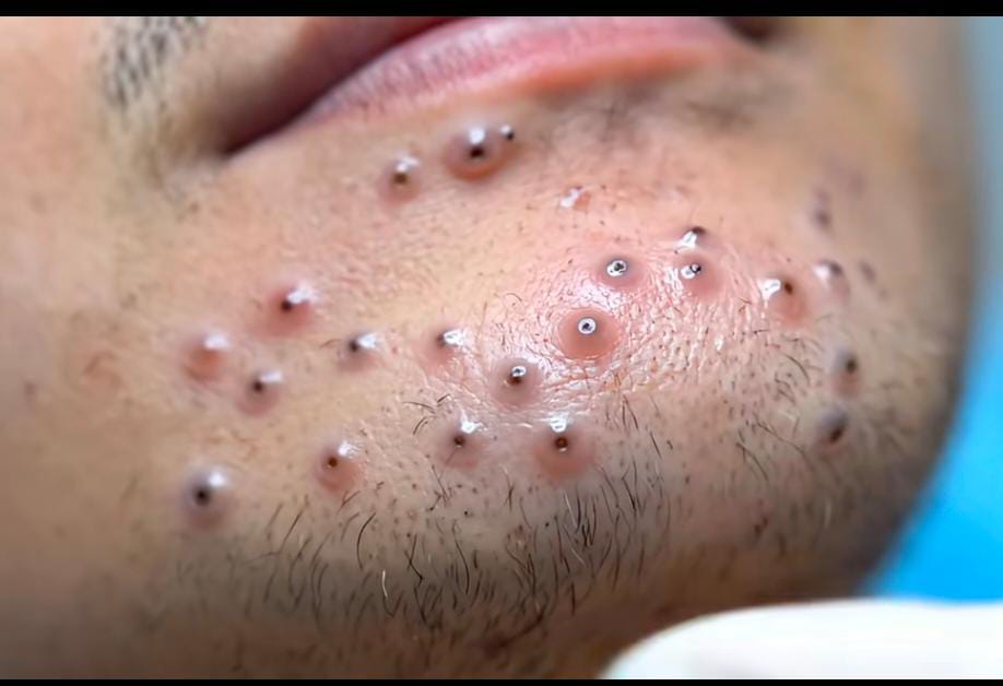 Dr Ihab Suliman tweet media