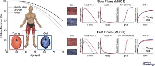 nsanzimanasabin's tweet image. IF YOU ARE OVER 40, your muscle mass naturally declines and that puts strength, mobility &amp;amp; metabolic health at risk.

But you can fight back: 

🚶‍♂️ Walk 10K steps/day
🏋️‍♀️ Strength train 2–3x/week

Backed by science: Grosicki et al., 2022￼; Nature Aging, 2025￼; NIH: PMC12675467￼