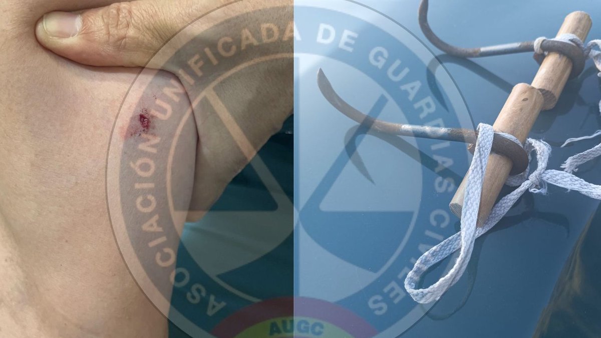 🔴 URGENTE | BRUTAL AGRESIÓN A UN GUARDIA CIVIL EN CEUTA

Día crítico en la frontera. Aprovechando la borrasca #Emilia, se suceden asaltos masivos a la valla y a nado.

⚠️ Un compañero ha sufrido una HERIDA PROFUNDA en el brazo tras ser atacado con un GARFÍO. El golpe iba