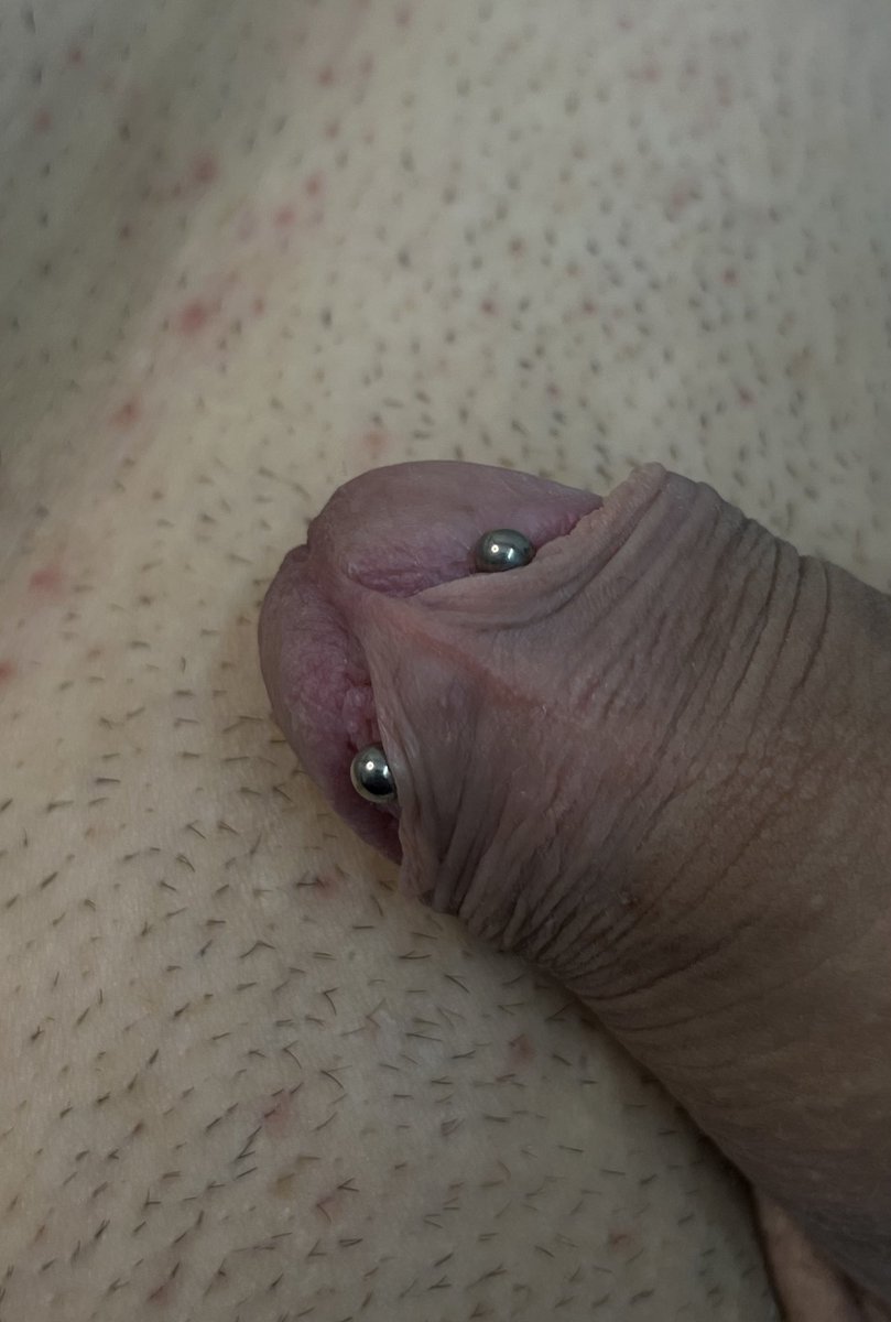 piercingbynano's tweet photo. ✖Frenum de hoy, espero por muchos trabajos así 👇🏼
Buscas un nuevo piercing o actualizar los tuyos por joyeria de titanio grado implante? Me podes encontrar en @macizo. std✖
◌
◌ 
◌
◌ 
#piercingbynano #bodypiercing #rosario #frenumpiercing #titaniumbodyjewelry https://t.co/T9bQa7cEO4