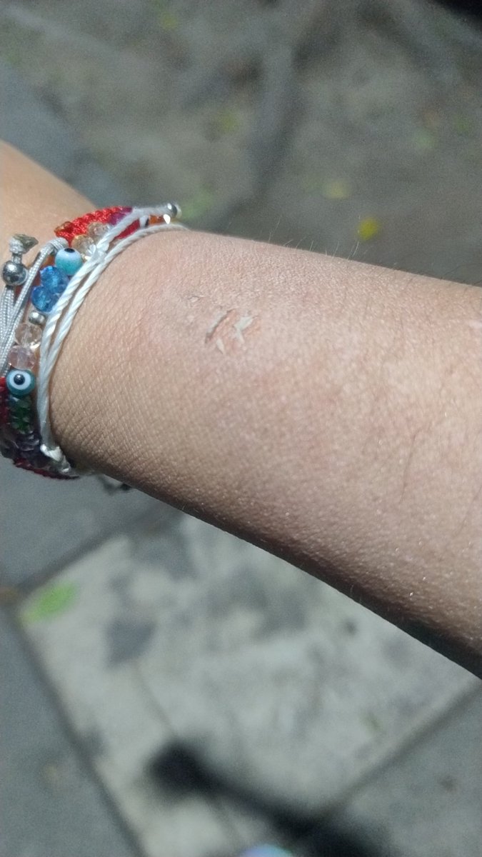 Piliflag's tweet photo. @MetrobusCDMX No hay policía, ni encargo en Mb Campeche L1 la puerta me golpeó y no hubo con quien dirigirme, los accidentes si pasan https://t.co/nSw9M57iaS