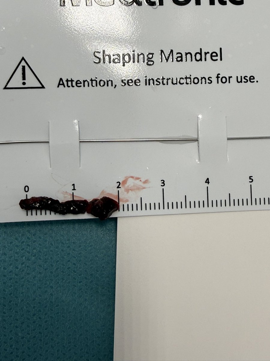 Cansado pero profundamente satisfecho. Siete minutos, movilidad y lenguaje recuperados en agudo.