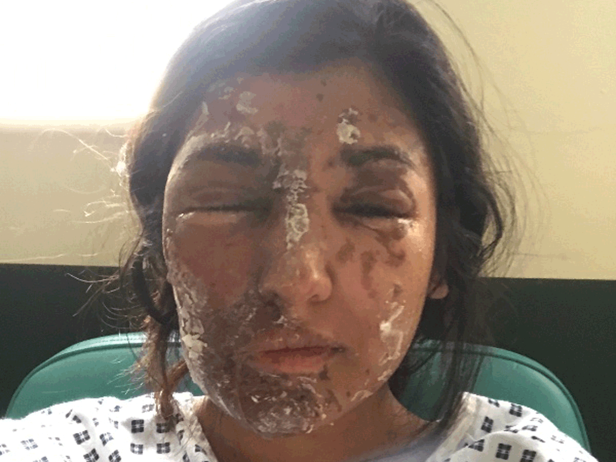 MarioNawfal's tweet photo. 🇺🇸 MIGRANT-LINKED ACID CRIMES SPREADING FROM EUROPE TO U.S., AMERICAN WOMEN NOW AT RISK 

A Georgia mom just had her face melted off walking her dog after church. 

Nothing was stolen. No words exchanged. Just acid to the face, then the guy ran.

This isn’t some freak accident. 

Acid attacks have exploded in Europe, especially the UK, where gangs and migrants weaponize cheap chemicals to maim random people. 

Now it’s happening in the U.S..

Savannah police called it one of the worst assaults they’ve ever seen. 

The attack mirrors ones in London hotspots like Newham and Tower Hamlets, where immigrant-heavy neighborhoods saw a 75% spike in acid crimes last year.

Still think this is fear-mongering? The UK ignored the warning signs too. 

They called it “isolated.” Then the hospital burn wards filled up.

Source: NYP, BBC, ABC