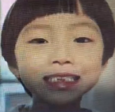 ไหนคุมแม่บอกว่าเอาออกนิดเดียว 😬