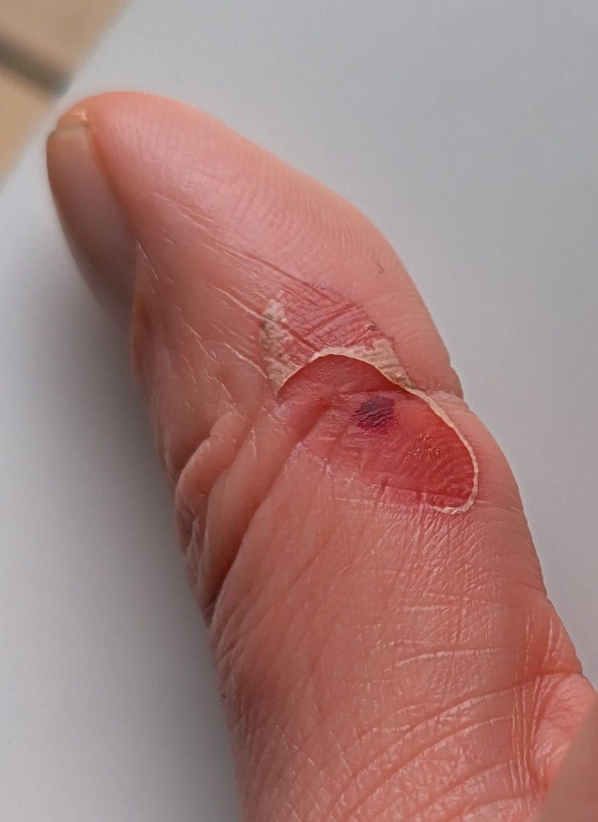 Pues ayer dediqué gran parte de la mañana a convertir ésta pletina de acero en un cuchillo tradicional vikingo, eso sí me llevé una herida de guerra...