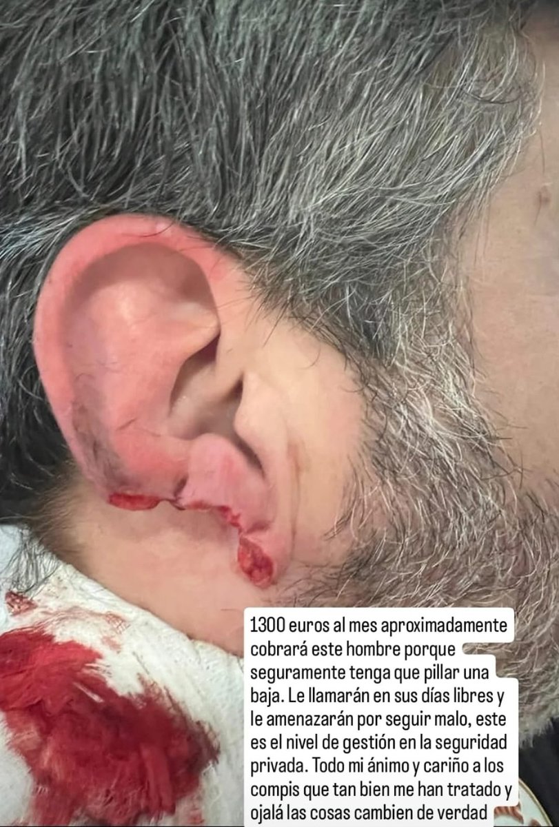 Agresiones y apuñalamientos a vigilantes de seguridad es un tema cotidiano,los cuales ya NO son noticia...
Un vigilante de seguridad y una agresión más. Esto es lo que sucede a diario en nuestra profesión y nadie hace nada para remediarlo.
Esto ocurrió en el CHUAC
#seguridad