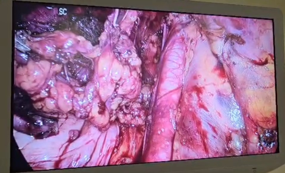 Robert Kalyesubula,MD, FISN(USA), PhD-FRCP(London) tweet media