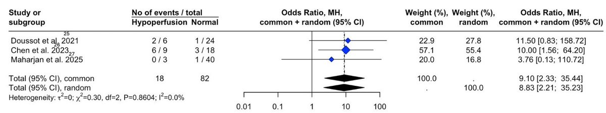 HPBEverestMD's tweet photo. Pancreatic neck = vascular watershed in PD &amp; left pancreatectomy. Mobilization risks stump devascularization. ICG fluorescence offers objective perfusion assessment vs subjective signs. Meta-analysis shows ↑ POPF risk with hypoperfusion (OR ~8.8), RCTs  awaited (VIPR-1 trial) https://t.co/ZJalm0PzOP