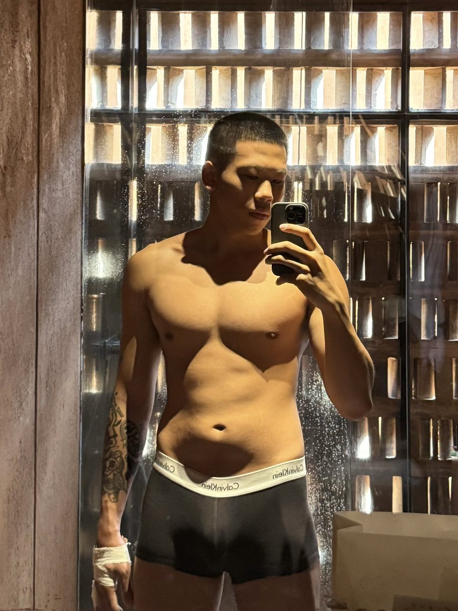 fudgehands's tweet image. Back when I fractured my hand 🙃