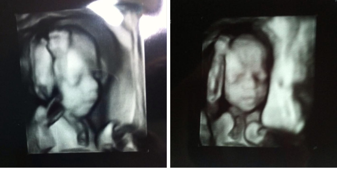 This is what a baby looks like 3 1/2 months before it is born.